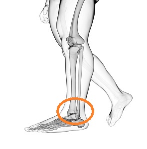 OFZ Sprunggelenk Spezialist